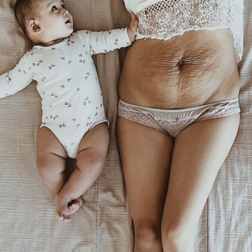 A woman's body undergoing rapid changes after childbirth