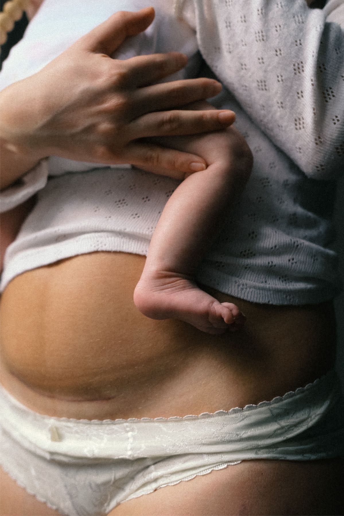 Accouchement par césarienne : tout ce que les mamans doivent savoir